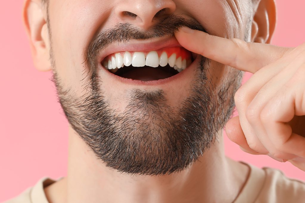 Guard Your Gums: Comprehensive Periodontal Treatment at Red Lion Dental